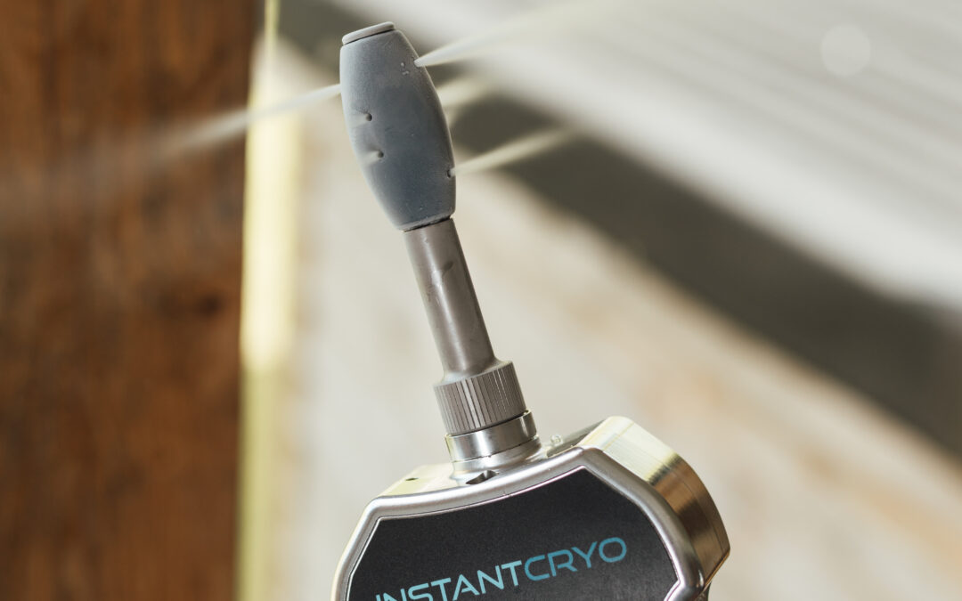 A cryo wand roller for facial treatments.