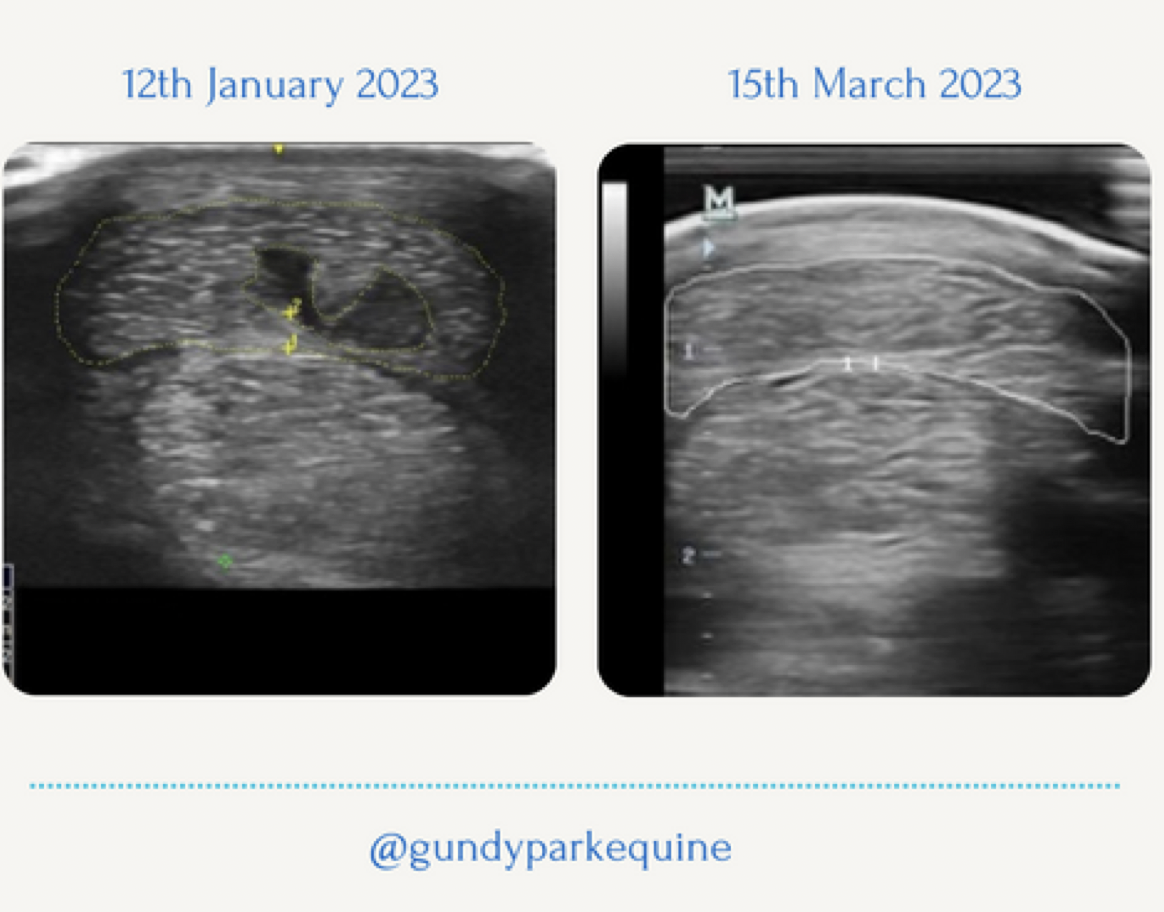 An ultrasound showing healing of a superficial digital tendon injury on a horse after cryotherapy treatments. 